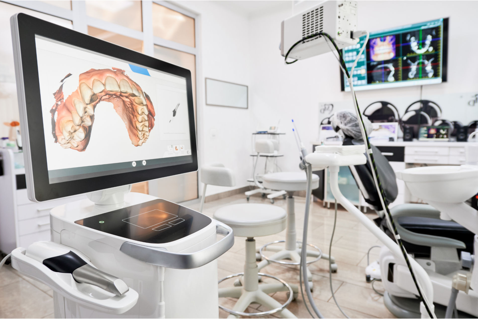Intraoralscanner