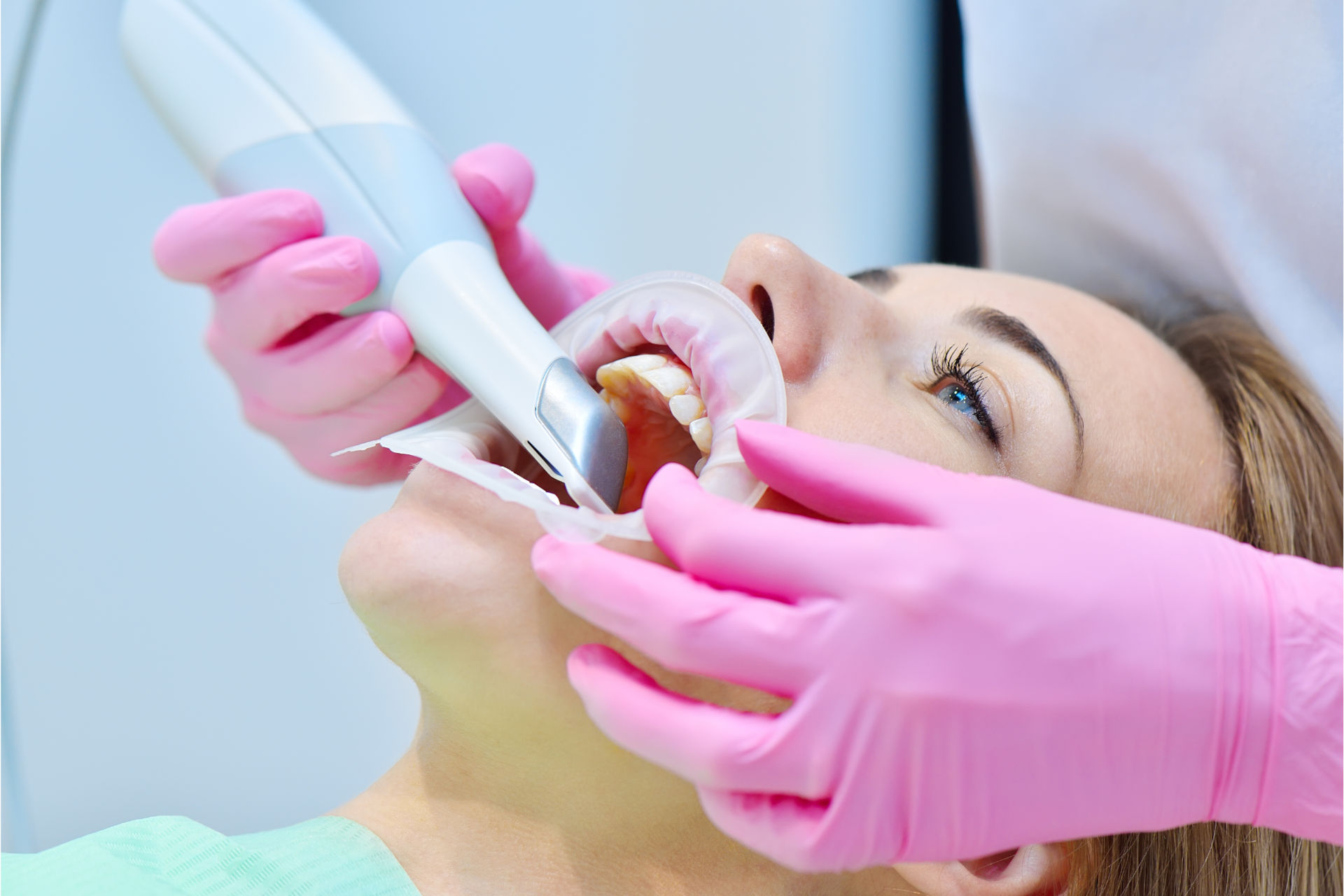 Intraoralscanner